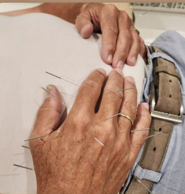 Get a grip – Acupuncture for Hands Affected by Arthritis and Neuropathy