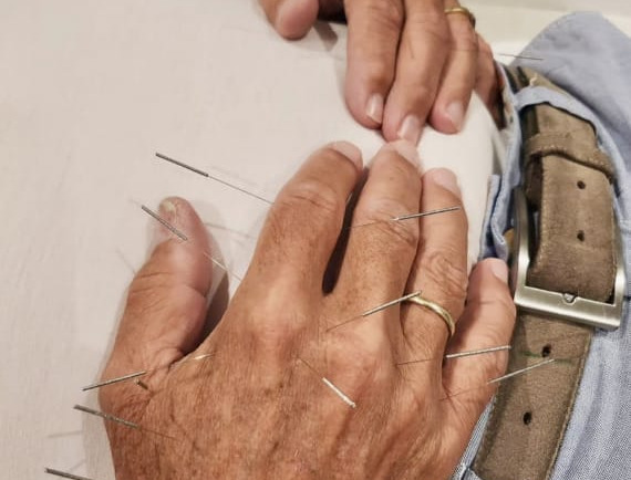Get a grip – Acupuncture for Hands Affected by Arthritis and Neuropathy